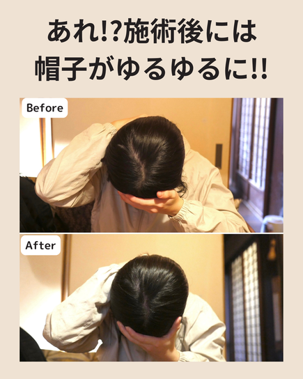 なぜ絶壁とハチ張りの方がこのような症状があるのか?