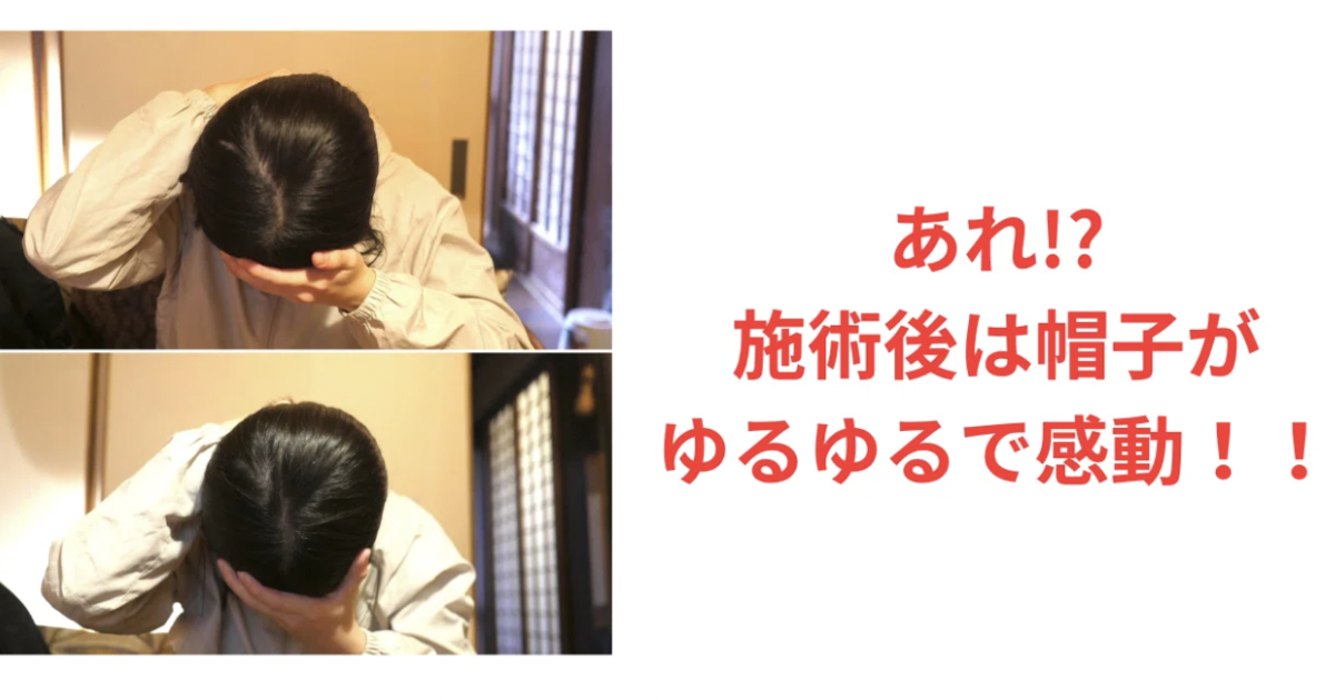 20代女性。斜頭症、頬骨の出っ張り、口角の左右差の改善症例